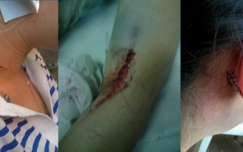 Familiares y amigos piden justicia por una joven que fue brutalmente atacada por su ex pareja