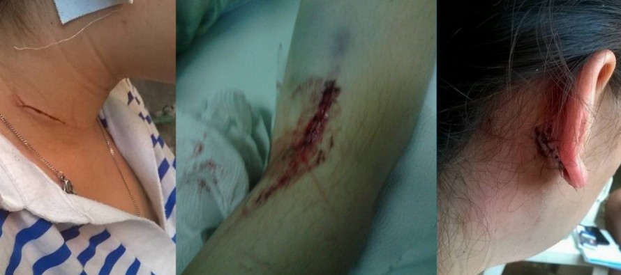 Familiares y amigos piden justicia por una joven que fue brutalmente atacada por su ex pareja