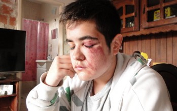 Agredieron a un joven de 15 años al resistirse a un robo en Brandsen y 9 de Julio a plena luz del día