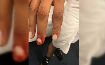 La Pantera peleó con un dedo fisurado por un accidente previo al combate