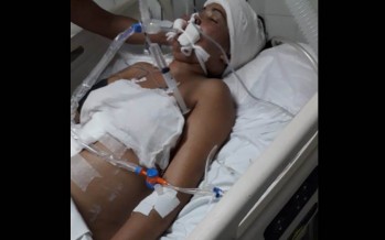 Parte médico de Camila Pradines, la joven agredida por su pareja en el barrio Mil Viviendas