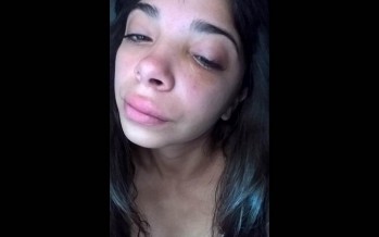 Una mujer denuncia que fue agredida físicamente por la madre de su novio y ahora la tienen que operar