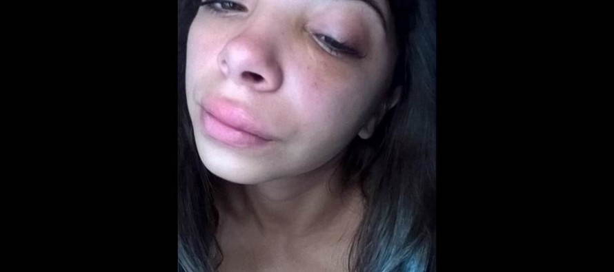 Una mujer denuncia que fue agredida físicamente por la madre de su novio y ahora la tienen que operar