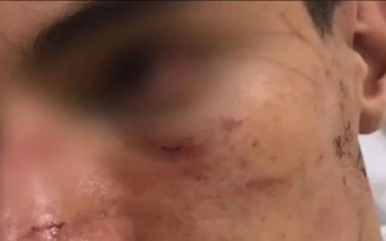 Un rugbier del Club San Fernando fue brutalmente golpeado por una patota
