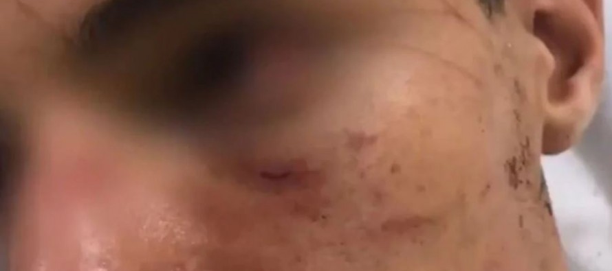 Un rugbier del Club San Fernando fue brutalmente golpeado por una patota