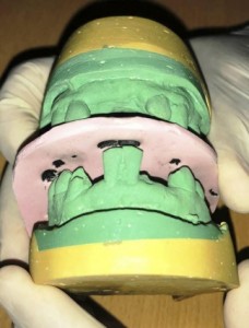 Mordedura del femicidio