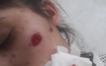 Virreyes: una mujer recibió un impacto en el rostro mientras viajaba en su auto