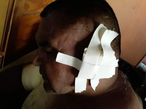 trabajador municipal agredido en san pablo