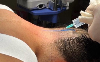 El Hospital Cordero realizó la primera neurocirugía pediátrica a un niño de 11 años