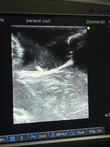 neurocirugía pediátrica